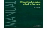 Manual de Radiología de Tórax - JACQUEZ