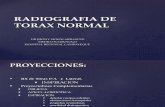Diagnóstico Por Imagen - Radiografía de Tórax Normal