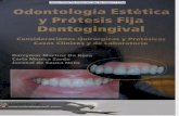 Odontologia Estética y Prótesis Fija Dentogingival - Darcymar Martins