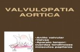 Valvulopatia Aortica Clase