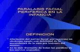Paralasis Facial