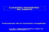 10- Luxacion Congenita de Cadera