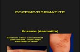 Curs Eczeme - Dermatite