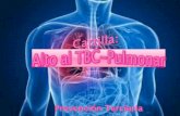 Alto al tbc pulmonar prevención terciaria