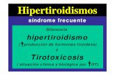 hipertiroidismo Tirotoxicosis