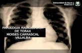Patologias radiologicas de torax