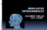 neoplasias intracraneales