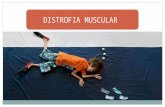 Presentacion distrofia muscular