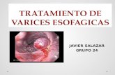 Tratamiento de varices esofagicas 2016