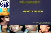 Adenitis Cervical