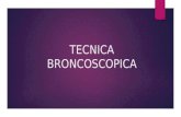 Tecnica broncoscopica