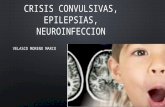Crisis convulsivas epilepsia neuroinfeccion