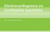 Electrocardiograma en Cardiopatía Isquémica
