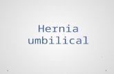 Hernia umbilical-cirugía