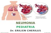 Neumonia - Parte  2 - Pediatria