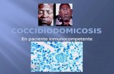 caso clinico de Coccidiodomicosis paciente inmunocompetente