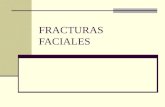 Clase fracturas+faciales