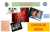 Estudio de caso cancer de riñon
