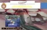 Indicaciones y contraindicaciones de exodoncia simple. técnica de exodoncia simple maxilar superior e inferior