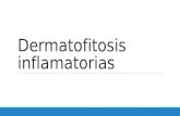 Dermatofitosis inflamatorias