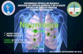 Neumon­a en pediatr­a - Pediatr­a de Nelson