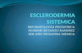 Esclerodermia sistemica