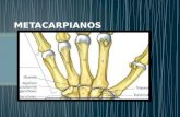 Huesos metacarpianos de la mano