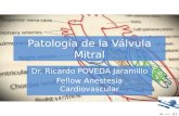 Mitral valve disease
