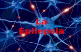 La Epilepsia.