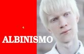 Albinismo belen ayude