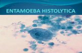 Entamoeba histolytica -amoebiasis