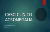 Caso clinico de acromegalia