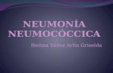 Neumonía neumocóccica