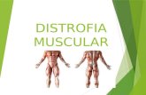 Distrofia muscular y espina bifida