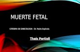 Muerte Fetal