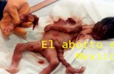 El aborto en México..