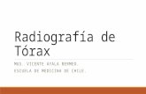Radiograf­a de t³rax