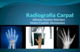 Radiografía carpal