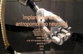 Implante de brazo antropomórfico neuronal 1002