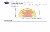 O multidisciplinaria) - Ortocervera Cursos de Ortodonciaortocervera.com/wp-content/uploads/2014/12/17-01-Tipodonto-ORTOD... · Texto. Dibujo Digital: ... (Ortodoncia multidisciplinaria)
