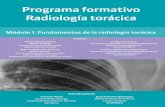 Programa formativo Radiología torá · PDF fileguir en la lectura de ambas técnicas. La radiografía de tórax es el examen ra-diológico más útil y comúnmente utili- ... (Rx)