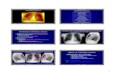 1 Generales de la lesión Q - · PDF file1 Aplicación Multimedia para la Enseñanza de Radiología a Alumnos de Medicina 1/74 Radiología Torácica II AMERAM v.1.0 ©2006 F. Sendra