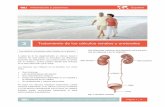 03 Tratamiento de los c lculos renales y ureteralespatients.uroweb.org/fileadmin/files/spanish/03_Tratamiento_de_los... · Información a pacientes - Tratamiento de los cálculos