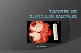 TUMORES DE GLANDULAS SALIVALES - fundacyc.orgfundacyc.org/gland_saliv.pdf · N. AURICULAR MAYOR ... Tumor invade la base del cráneo, el séptimo nervio, y/o tiene más de 6 cm .