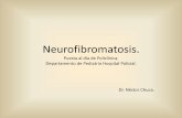 Neurofibromatosis. Ateneo de Policlínica. La Neurofibromatosis (NF) forma parte de los síndromes neurocutáneos, los cuales se caracterizan por la asociación de trastornos neurológicos