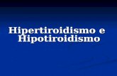 [PPT]Hipertiroidismo e Hipotiroidismo · Web viewHipertiroidismo e Hipotiroidismo Anatomía Fisiologia Tiroides Producción tiroxina (T4) y triiodotironina (T3). regulan el metabolismo