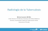 Radiología de la Tuberculosis Abdomen : Buscar hígado, estructuras normales llenas de gas (estómago y colon ) •Anomalías : aire libre Liver Gastric Bubble Splenic Flexure Radiografía