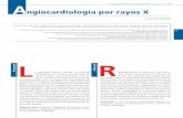 X-ray angiocardiology - revistahipertension.com.verevistahipertension.com.ve/rlh_12_1_2017/angiocardiologia.pdf20 os rayos X son un ... corriente eléctrica del orden de varios Ampers,