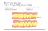 Biomecánica - Ortocervera Cursos de Ortodonciaortocervera.com/wp-content/uploads/2014/12/21-02... · Ortodoncia Multidisciplinaria - Typodonto | 17 • OBJETiVOS - Enderezamiento
