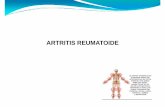 ARTRITIS REUMATOIDE [Modo de compatibilidad] REUMAT… · criterios ACR/EULAR de 2010 permiten la clasificación como artritis reumatoide con la presencia de sinovitis de al menos